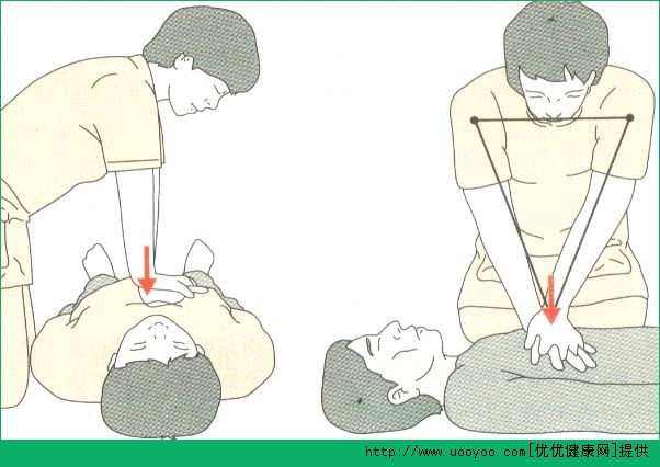 心脏骤停17分钟死而复生 掌握正确的心肺复苏术很有必要(5)